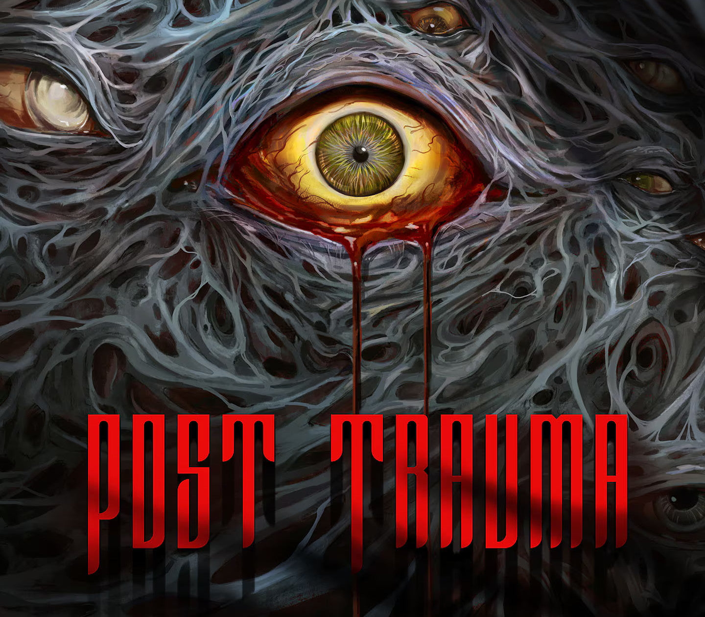 Post Trauma